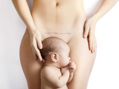 Comment j'ai surmonté la baisse de libido après l'accouchement